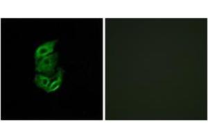 Immunofluorescence analysis of A549 cells, using STA13 Antibody. (STARD13 antibody  (AA 101-150))