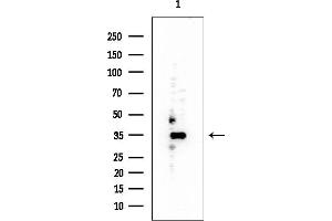 anti-Peroxisomal Biogenesis Factor 7 (PEX7) (C-Term) antibody