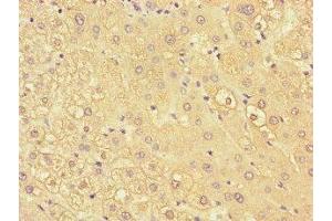 Immunohistochemistry of paraffin-embedded human liver tissue using ABIN7157503 at dilution of 1:100 (KIR2DL3 antibody  (AA 22-245))