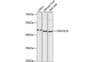 Western blot analysis of extracts of various cell lines, using CRA antibody (ABIN6132088, ABIN6139000, ABIN6139002 and ABIN6217974) at 1:3000 dilution. (EFCAB4B antibody  (AA 1-200))