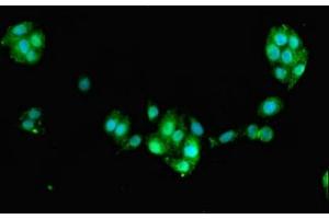 Immunofluorescent analysis of PC-3 cells using ABIN7160449 at dilution of 1:100 and Alexa Fluor 488-congugated AffiniPure Goat Anti-Rabbit IgG(H+L) (FAM168B antibody  (AA 43-100))