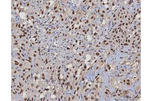 IHC analysis of MSH2 using anti-MSH2 antibody (ABIN7601369).
