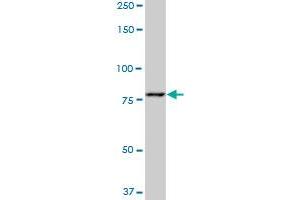 PFKM monoclonal antibody (M04), clone 1D1. (PFKM antibody  (AA 681-780))