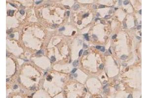 Immunohistochemical staining of formalin-fixed paraffin-embedded rat kidney tissue with PLXNB1 polyclonal antibody  at 1 : 100 dilution. (PLXNB1 antibody  (N-Term))