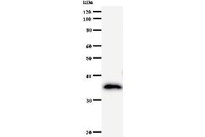 Western Blotting (WB) image for anti-Nucleoporin 93kDa (NUP93) antibody (ABIN931082)