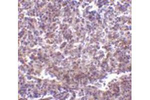 Immunohistochemistry of CD180 in human spleen tissue with CD180 polyclonal antibody  at 2 ug/mL . (CD180 antibody  (N-Term))
