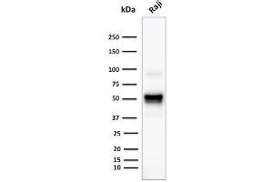 Western Blot Analysis of human Rajj cell lysate using CD79a Monoclonal Antibody (SPM549). (CD79a antibody  (AA 202-216))