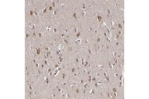 Immunohistochemical staining of human cerebral cortex with TNRC4 polyclonal antibody  shows distinct cytoplasmic positivity in neurons at 1:20-1:50 dilution.