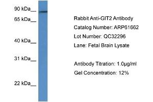 Western Blotting (WB) image for anti-G Protein-Coupled Receptor Kinase Interactor 2 (GIT2) (C-Term) antibody (ABIN2788863) (GIT2 antibody  (C-Term))