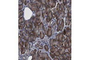 Immunohistochemistry (IHC) image for anti-Hepatocyte Growth Factor-Regulated tyrosine Kinase Substrate (HGS) (Internal Region) antibody (ABIN6262232)