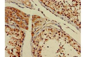 Immunohistochemistry of paraffin-embedded human testis tissue using ABIN7154122 at dilution of 1:100 (GSTT1 antibody  (AA 2-240))