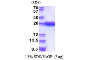 SDS-PAGE (SDS) image for StAR-Related Lipid Transfer (START) Domain Containing 5 (STARD5) (AA 1-213) protein (His tag) (ABIN5853380)