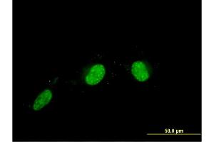 Immunofluorescence of monoclonal antibody to CALCOCO2 on HeLa cell. (CALCOCO2 antibody  (AA 347-446))