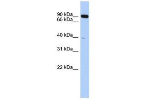 WB Suggested Anti-CXXC1 Antibody Titration:  0. (CXXC1 antibody  (Middle Region))