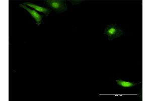 Immunofluorescence of purified MaxPab antibody to NUDC on HeLa cell. (NUDC antibody  (AA 1-331))