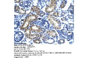Human kidney (SIX Homeobox 6 antibody  (N-Term))