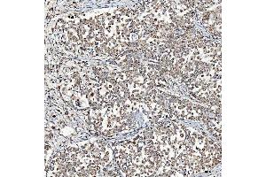 IHC analysis of SFXN3 using anti-SFXN3 antibody (ABIN7601302). (SFXN3 antibody  (AA 32-321))