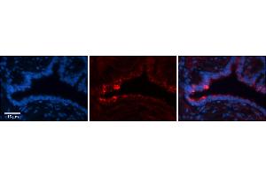 Rabbit Anti-NETO2 Antibody     Formalin Fixed Paraffin Embedded Tissue: Human Bronchial Epithelial Tissue  Observed Staining: Cytoplasmic  Primary Antibody Concentration: 1:100  Secondary Antibody: Donkey anti-Rabbit-Cy3  Secondary Antibody Concentration: 1:200  Magnification: 20X  Exposure Time: 0. (NETO2 antibody  (N-Term))