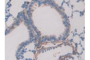 Immunohistochemistry (IHC) image for anti-Fibrillin 1 (FBN1) (AA 751-895) antibody (ABIN7432139)