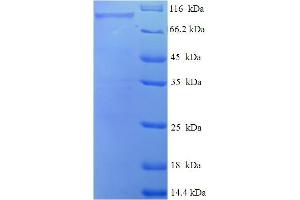 SDS-PAGE (SDS) image for Peroxisomal Bifunctional Enzyme (ECHP) (AA 1-723), (full length) protein (His-SUMO Tag) (ABIN5711237)