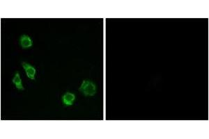 Immunofluorescence analysis of MCF7 cells, using GPRC5D Antibody.