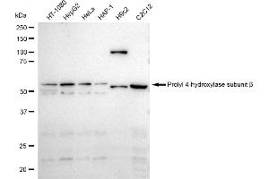 Western blotting analysis using Prolyl 4-hydroxylase subunit beta antibody (ABIN7799920). (Recombinant P4HB antibody)