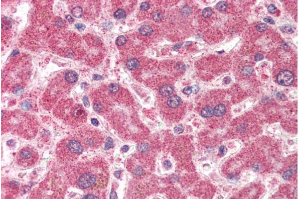 IFT74 antibody