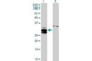Western Blot analysis of ULBP2 expression in transfected 293T cell line by ULBP2 MaxPab polyclonal antibody. (ULBP2 antibody  (AA 1-246))