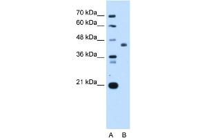 WB Suggested Anti-ST3GAL4 Antibody Titration:  0. (ST3GAL4 antibody  (Middle Region))