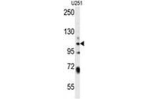 WWC3 Antibody (C-term) western blot analysis in U251 cell line lysates (35 µg/lane).