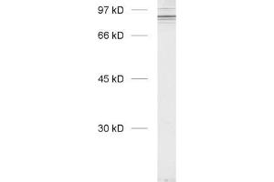 Western Blotting (WB) image for anti-Cortactin (CTTN) (N-Term) antibody (ABIN1742565) (Cortactin antibody  (N-Term))