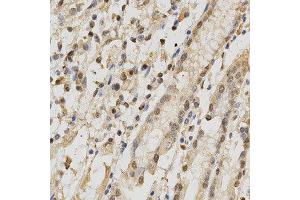 Immunohistochemistry of paraffin-embedded human stomach using RBFOX3 antibody at dilution of 1:200 (x400 lens). (NeuN antibody)