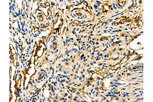 ABIN6261239 and ABIN6276806 at 1/100 staining Mouse ovarian tissue by IHC-P. (Decorin antibody  (Internal Region))