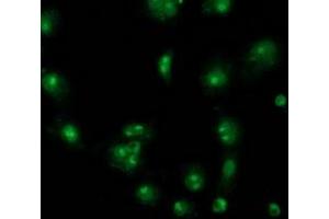 Anti-CDCP1 mouse monoclonal antibody (ABIN2454040) immunofluorescent staining of COS7 cells transiently transfected by pCMV6-ENTRY CDCP1 (RC220633). (CDCP1 antibody)