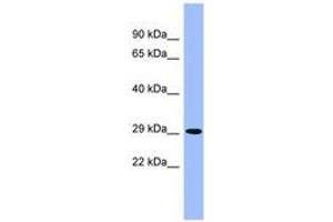 Image no. 1 for anti-Phytanoyl-CoA 2-Hydroxylase (PHYH) (AA 251-300) antibody (ABIN6741810) (PHYH antibody  (AA 251-300))