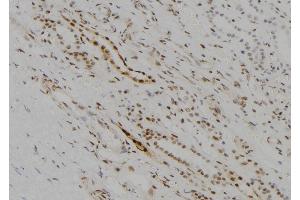 ABIN6273678 at 1/100 staining Human kidney tissue by IHC-P. (KDM5D antibody  (C-Term))