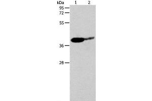Western Blot analysis of Mouse brain and Human liver cancer tissue using SIRT3 Polyclonal Antibody at dilution of 1:500 (SIRT3 antibody)