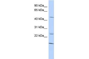 WB Suggested Anti-BARHL2 Antibody Titration:  0. (BARHL2 antibody  (Middle Region))
