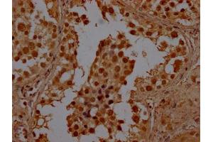 IHC image of ABIN7147833 diluted at 1:100 and staining in paraffin-embedded human testis tissue performed on a Leica BondTM system.
