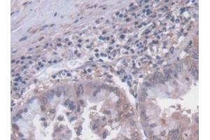 Used in DAB staining on fromalin fixed paraffin-embedded Liver tissue (SLC30A8 antibody  (AA 263-369))