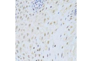 Immunohistochemistry (Paraffin-embedded Sections) (IHC (p)) image for anti-Apoptosis-Inducing Factor, Mitochondrion-Associated, 1 (AIFM1) (AA 334-613) antibody (ABIN3023385)