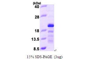 SDS-PAGE (SDS) image for Stathmin 3 (STMN3) (AA 39-180) protein (His tag) (ABIN667138) (Stathmin 3 Protein (STMN3) (AA 39-180) (His tag))