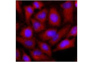 Immunofluorescenitrocellulosee of human HeLa cells stained with monoclonal anti-human OAT anitbody (1:500) with Texas Red (Red). (OAT antibody  (AA 33-439))
