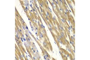 Immunohistochemistry of paraffin-embedded rat heart using TYR antibody. (TYR antibody  (AA 20-340))