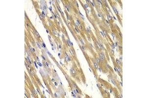 Immunohistochemistry of paraffin-embedded rat heart using TYR antibody. (TYR antibody  (AA 20-340))