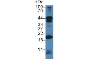 CHN2 antibody  (AA 101-323)