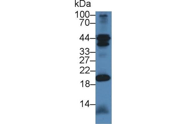 CHN2 抗体  (AA 101-323)