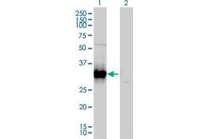 Western Blot analysis of FRG1 expression in transfected 293T cell line by FRG1 monoclonal antibody (M01), clone 4A5. (FRG1 antibody  (AA 1-258))