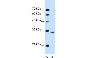 WB Suggested Anti-ACVR2B Antibody Titration:  0. (ACVR2B antibody  (C-Term))