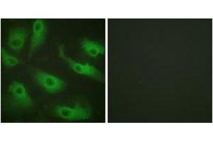 Immunofluorescence analysis of HeLa cells, using CDC37 (Ab-13) Antibody. (CDC37 antibody  (AA 1-50))